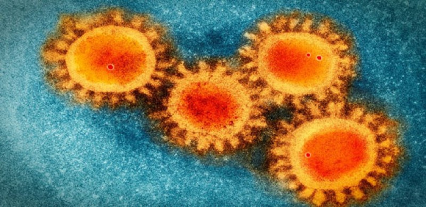 coronavirus