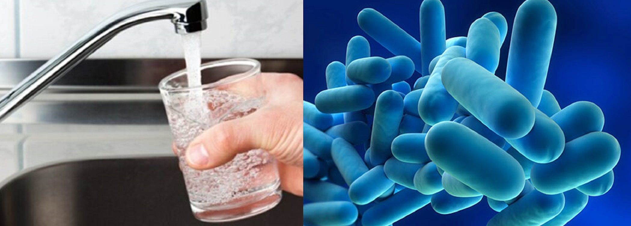 i sintomi della legionella