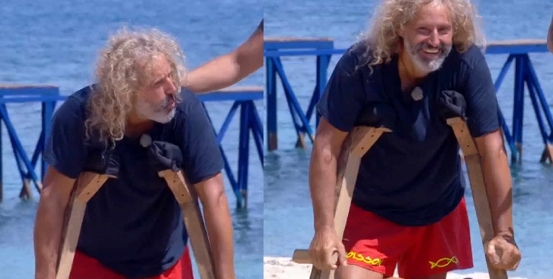 isola dei famosi infortunio nick cugini dei campagna