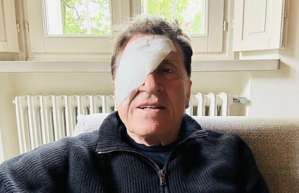 Gianni Morandi sui social con una benda all'occhio destro