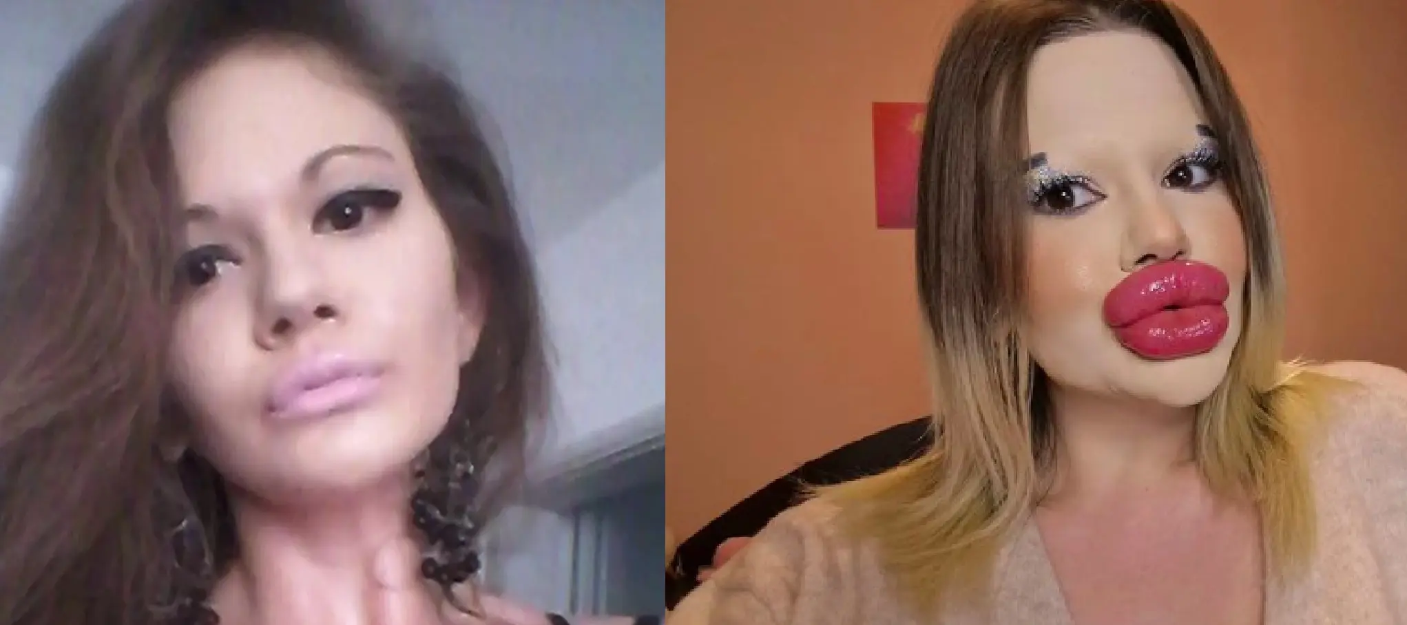 ‘Le labbra più grandi del mondo’: chi è Andrea Ivanova, l’influencer che ha trasformato il suo volto ‘Le labbra più grandi del mondo’: chi è Andrea Ivanova, l’influencer che ha trasformato il suo volto
