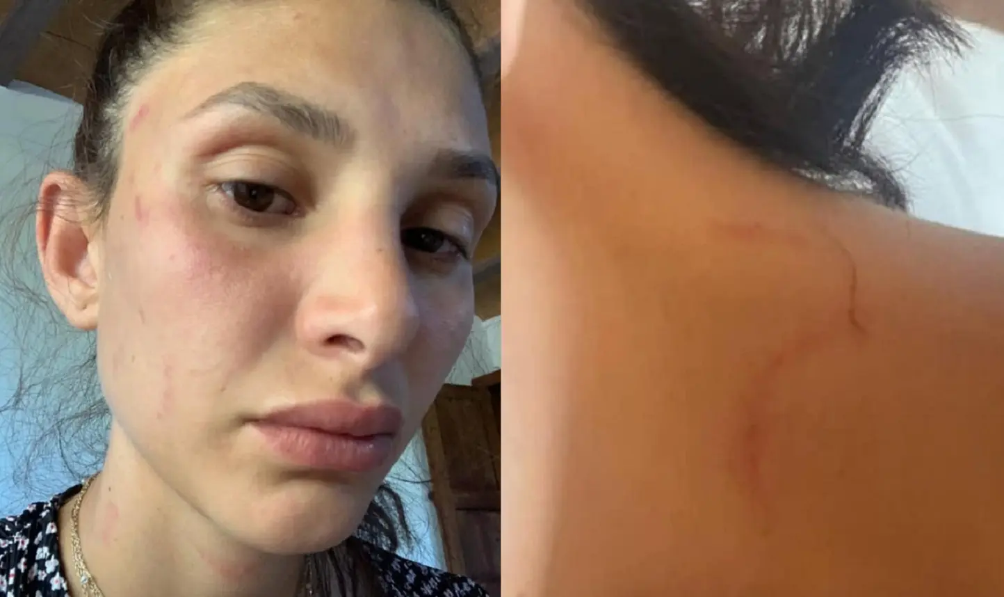‘Ti amo e farò di tutto’, Can Yaman dopo la denuncia social di Sara Bluma: cosa è successo con l’ex ‘Ti amo e farò di tutto’, Can Yaman dopo la denuncia social di Sara Bluma: cosa è successo con l’ex