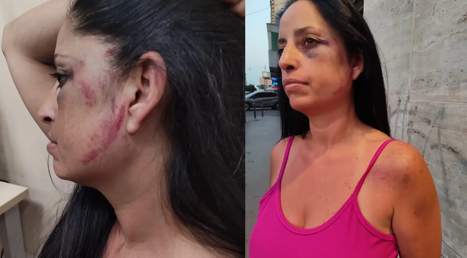 Napoli, aggredita dal compagno della figlia: madre costretta a trasferirsi per paura