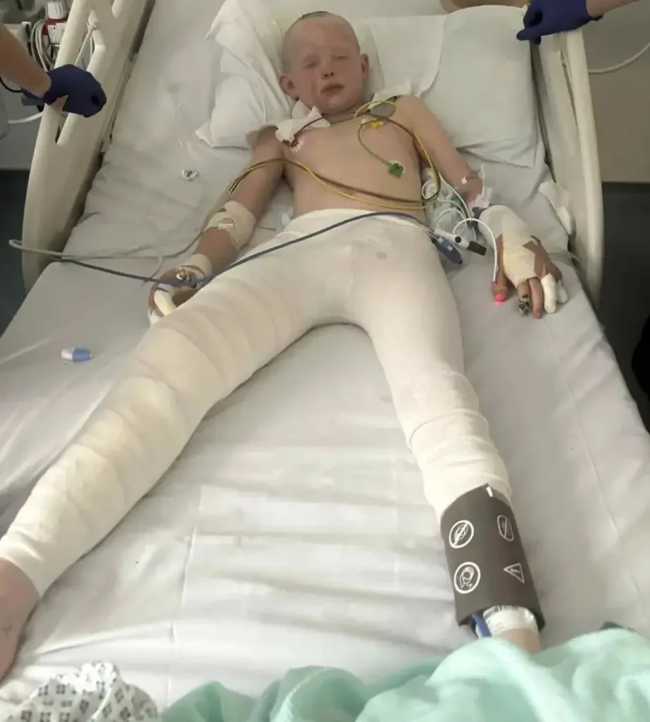 Le terribili condizioni di Hunter dopo l'incidente