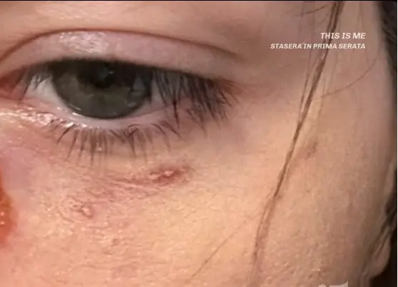Il viso di Pamela dopo un'aggressione subita in passato