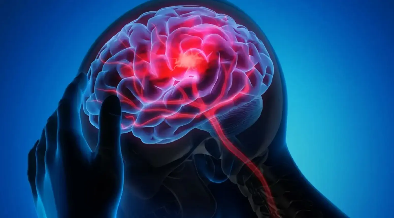 Ictus, ogni 3 secondi un nuovo caso nel mondo: ‘Il 90% si può prevenire’, come si riconosce Ictus, ogni 3 secondi un nuovo caso nel mondo: ‘Il 90% si può prevenire’, come si riconosce