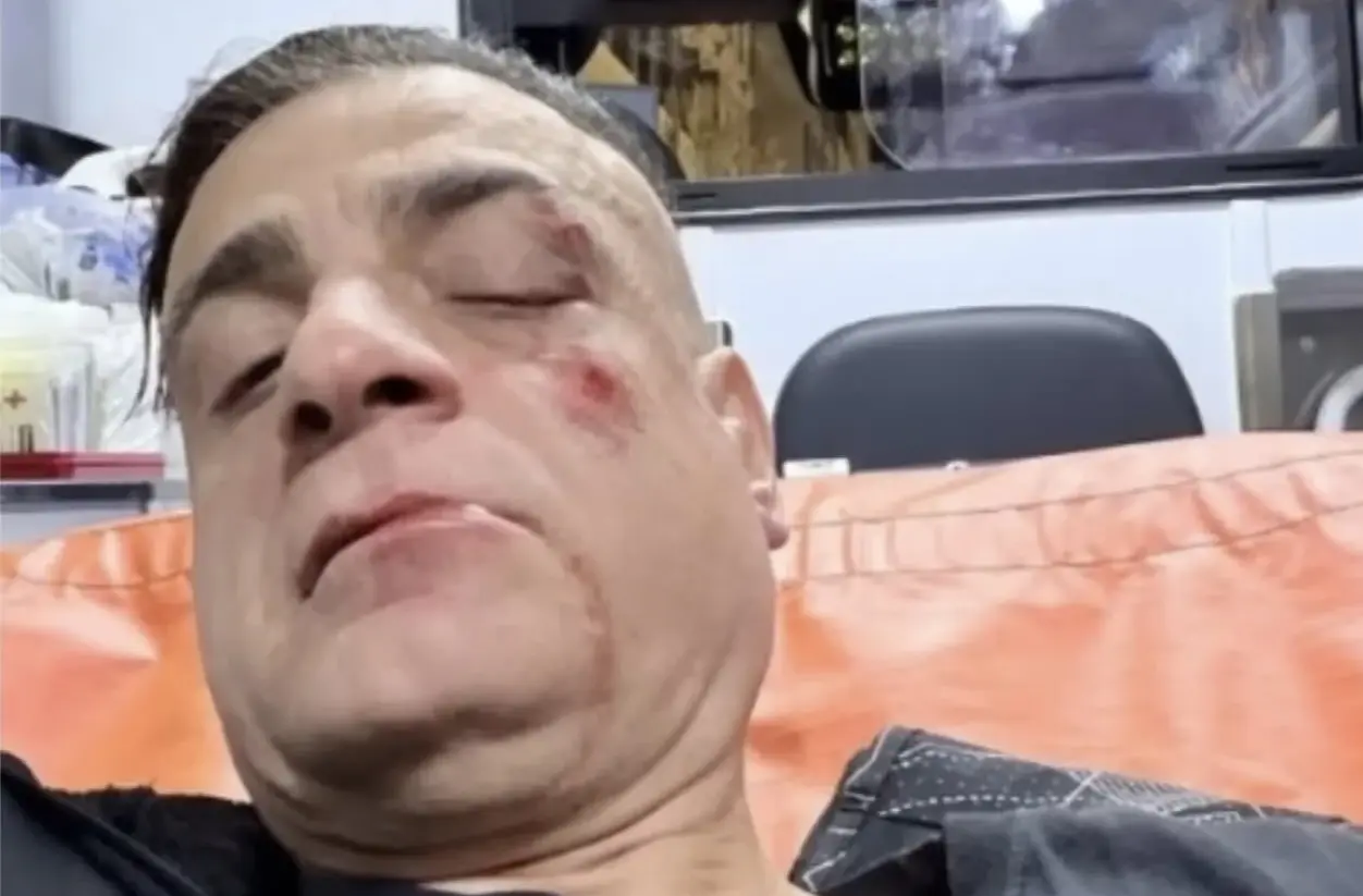 Roma, caos alla metro Ottaviano: lo youtuber Cicalone aggredito da una gang di borseggiatori