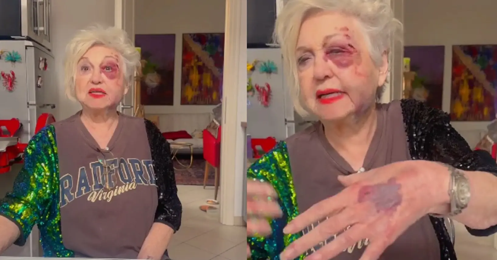 Wanna Marchi investita sulle strisce a Milano: ‘Mi hanno travolta, non ricordavo dove abitavo’