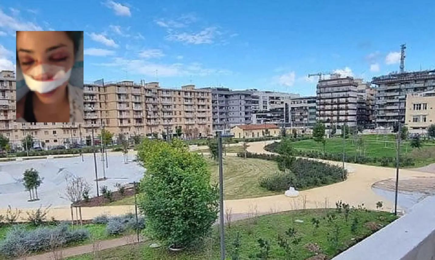 bari giuditta massacrata al parco rossani il sindaco la incontra volto devastato da una violenza inaudita da Notizieaudaci.it bari giuditta massacrata al parco rossani il sindaco la incontra volto devastato da una violenza inaudita